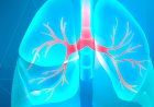 Investigadores desenvolvem técnica não-invasiva para caracterização do cancro do pulmão